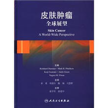 皮肤肿瘤：全球展望