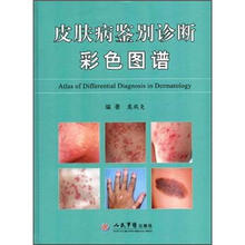 皮肤病鉴别诊断彩色图谱