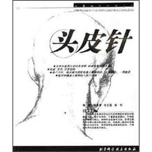 头皮针