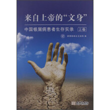 中国银屑病患者生存实录:来自上帝的“文身”