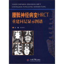 腰骶神经病变HRCT重建同层显示图谱