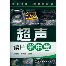 影像读片一学就会系列：超声读片掌中宝