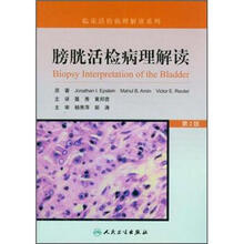 膀胱活检病理解读(翻译版)