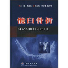 髋臼骨折
