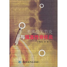 类风湿关节炎与强直性脊柱炎