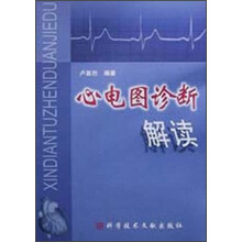心电图诊断解读