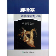 肺栓塞：多学科病例分析