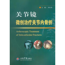 关节镜微创治疗关节内骨折