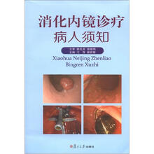 消化内镜诊疗病人须知