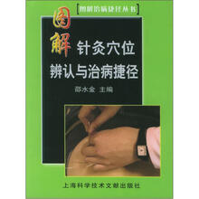 图解针灸穴位辨别与治病捷径