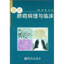 现代肺癌病理与临床