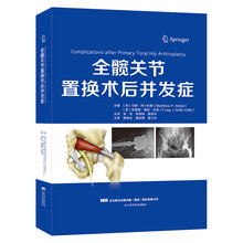 全膝关节置换术：综述与指南