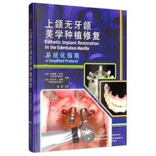 上颌无牙颌美学种植修复系统化指南