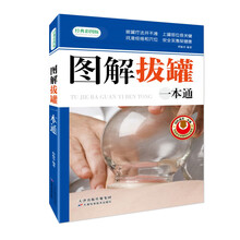 图解拔罐一本通（经典彩图版）