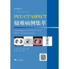 PET/CT与SPECT疑难病例集萃  临床精析病例集锦