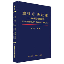 室性心动过速——600幅心电图实例