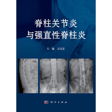 脊柱关节炎与强直性脊柱炎