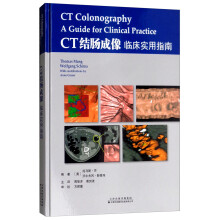 CT结肠成像：临床实用指南