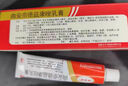 皮膚瘙癢皮炎濕疹真菌感染止癢越抓越癢皮膚藥膏止癢抑菌身體癢 皮膚用藥 曲安奈德益康唑乳膏【視覺(jué)特效】 2盒裝【皮炎濕疹過(guò)敏瘙癢】 曬單實(shí)拍圖