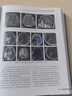 ESNR臨床神經(jīng)放射學(xué) 上下卷 張龍江 劉亞歐 腦血管疾病創(chuàng)傷炎癥癲癇腫瘤學(xué)神經(jīng)系統(tǒng)疾病影像學(xué)書籍病例神經(jīng)外科學(xué)內(nèi)科學(xué)放射科書籍 曬單實拍圖