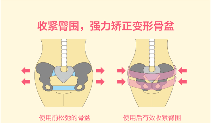 產後最少1-2個星期要進行骨盆收緊,2個月內對骨盆進行收緊是最理想的