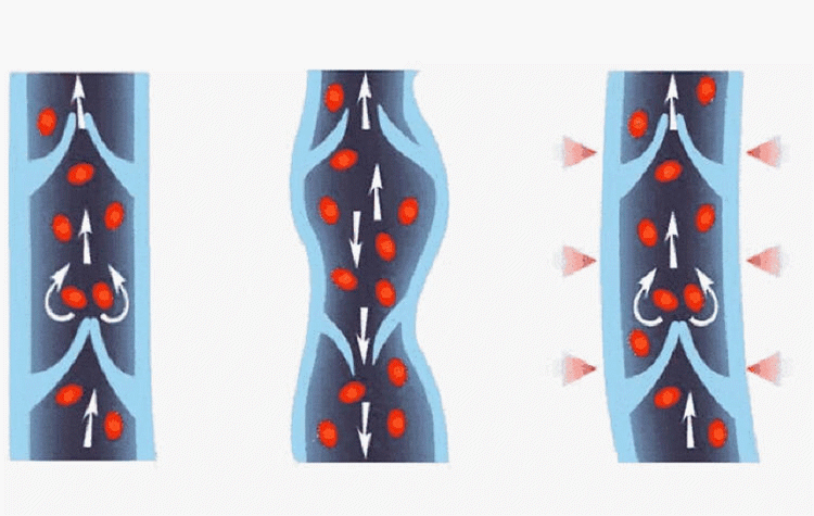 台湾金尼静脉曲张袜医用弹力袜治疗型压力袜连裤袜九分裤 三级连裤袜