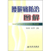 

腰腿痛防治图解