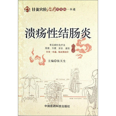 

针灸穴位治疗常见病一本通：溃疡性结肠炎