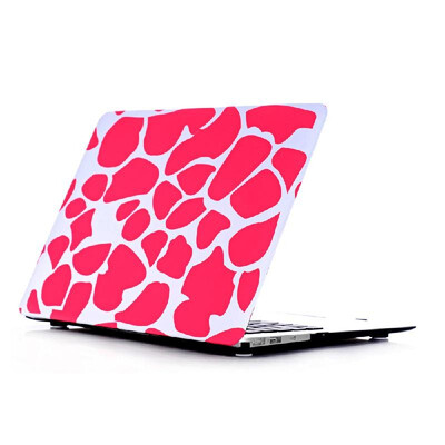 

Ultra Thin Light Weight Pink Stone Pattern Laptop Hard Case Shell Cover for Apple Macbook Air 11 116in