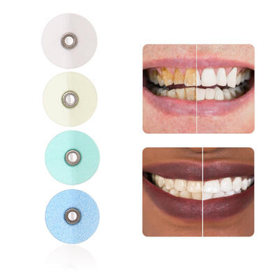 

Greensen 80Pcs Professional Dental Polish Disc Teeth Whitening Polish Discs Oral Care Tool