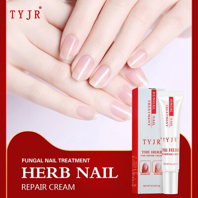 

Kills 999 Bacteria Nail Care Treatment Nail Fungus Oil Onychomycosis Paronychia Anti Fungal Nail Infection 15g Repair Nails