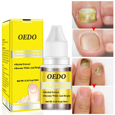 

10ml Nail Fungal Treatment Onychomycosis Removal Anti Fungus Nails Care Repair Liquid