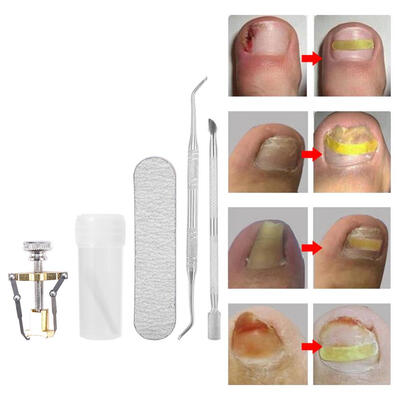

6PcsSet Toenail Correction Patch Dead Skin Pliers Ingrown Corrector Pedicure Tool Pedicure Tool Toenail Recover Tool