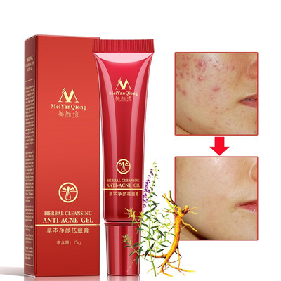

Face Brighten Cream Anti Acne Treatment Cleansing Gel Scar Removal Whitening Cream Acne Spots Removing