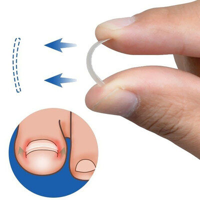 

10pcs A Incarnated Curve Runner BS Brace Paronychia Thick Hair Nail Correction Tool Great Popular