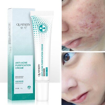

15g Acne Treatment Blackhead Remova Anti Acne Cream Oil Control Shrink Pores Acne Scar Remove Face Care Whitening