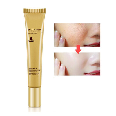 

whitening moisturizing Repair after-sun acne anti-aging anti-inflammatory relieving itching removes pigment