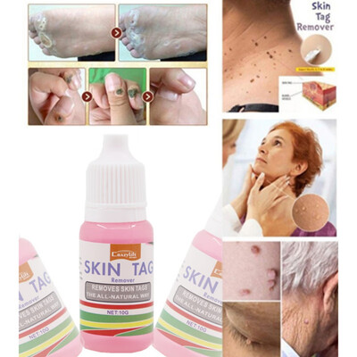 

Skin Tag Remover Foot Treatment Mole Skin Tag Body Warts Remover Skin Care Tools