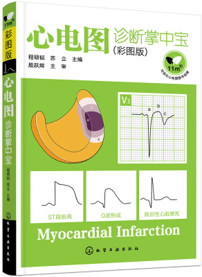 

心电图诊断掌中宝彩图版