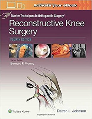 

Master Techniques in Orthopaedic Surgery Recons