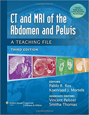 

CT & MRI of the Abdomen&Pelvis LWW Teaching