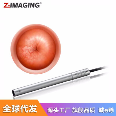 

Digital colposcope Gynecological self-examination mirror Peeping mirror Detector Cervical checker Digital voyeurism Endoscope