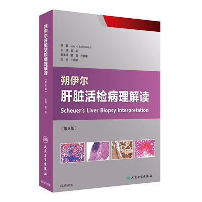 

朔伊尔肝脏活检病理解读(翻译版)