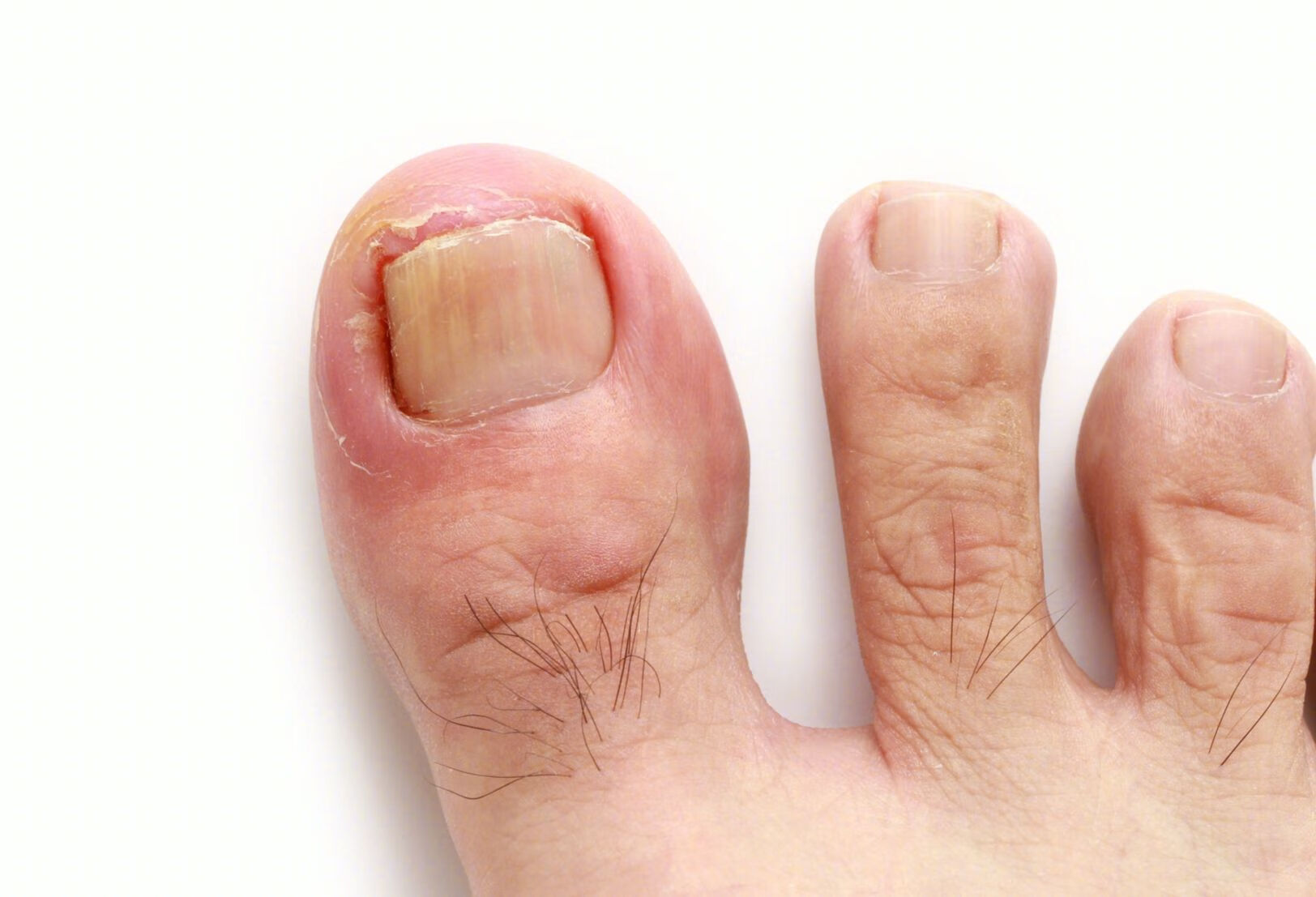 天津中医药大学第一附属医院(北院区)嵌甲推荐专家