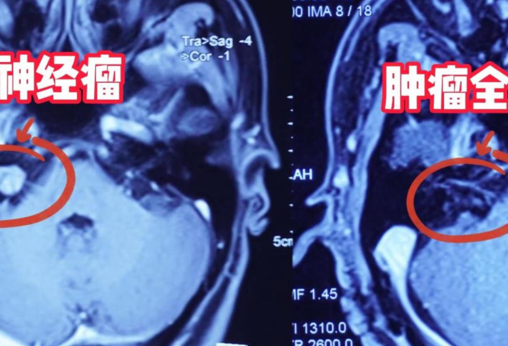 千阳县中医医院听神经瘤专家【预约挂号_图文问诊_电话问诊】 - 京东健康互联网医院