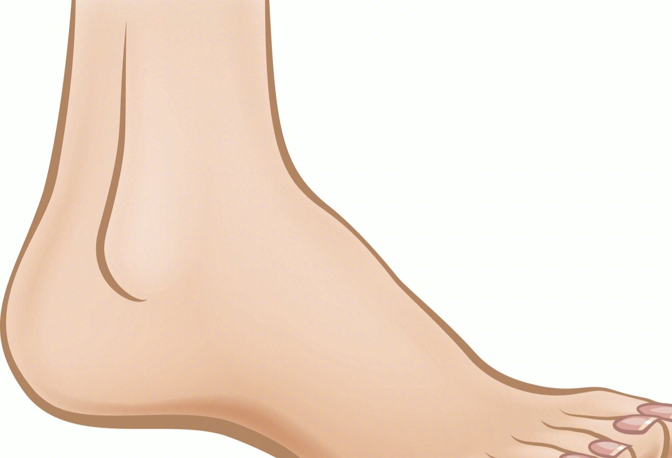 我脚趾伸不直,分不开,呈现爪状,脚底无知觉,持续一个月,之前曾扭伤过