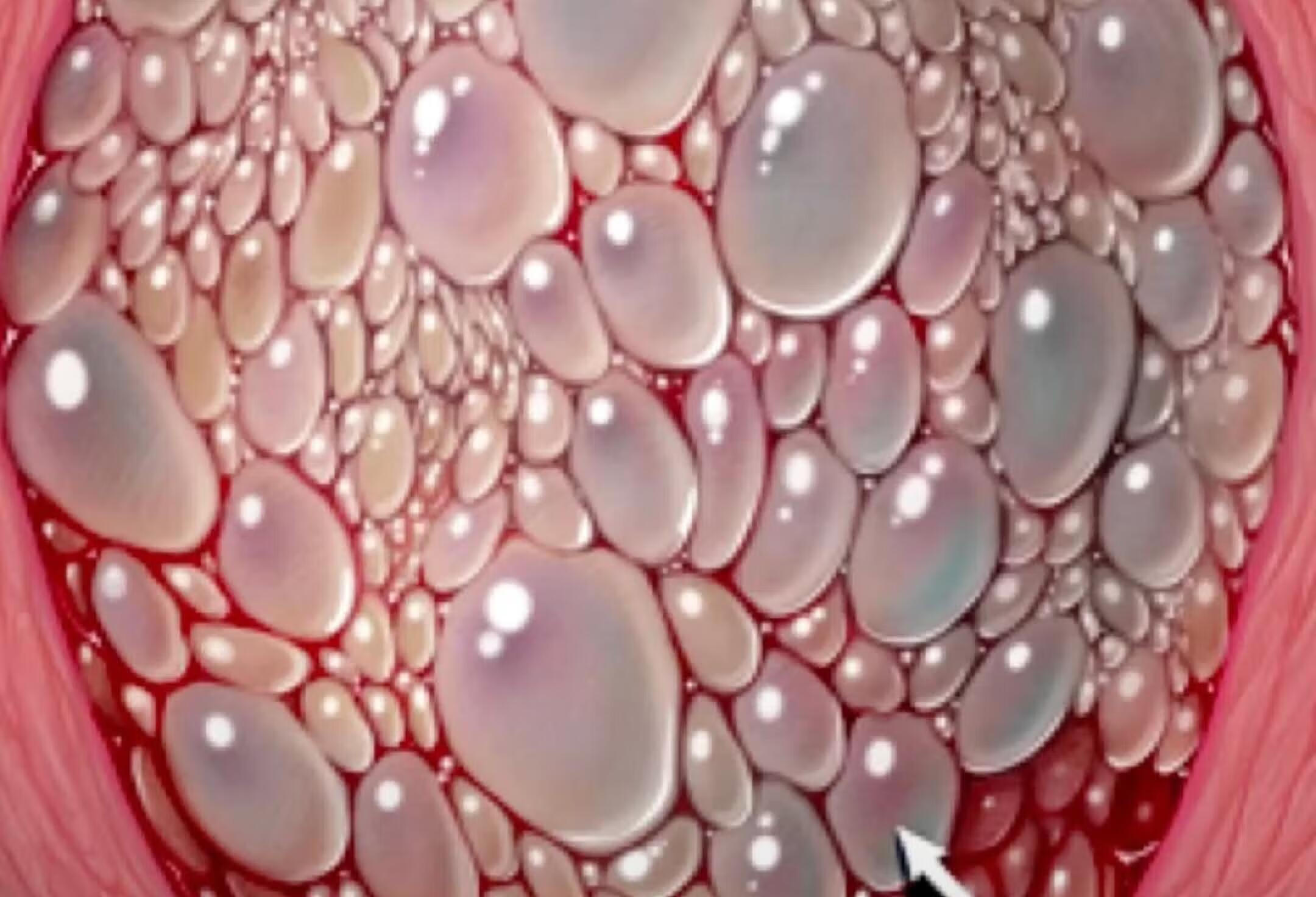 河南中医药大学第一附属医院-葡萄胎-专家在线问诊-京东健康互联网