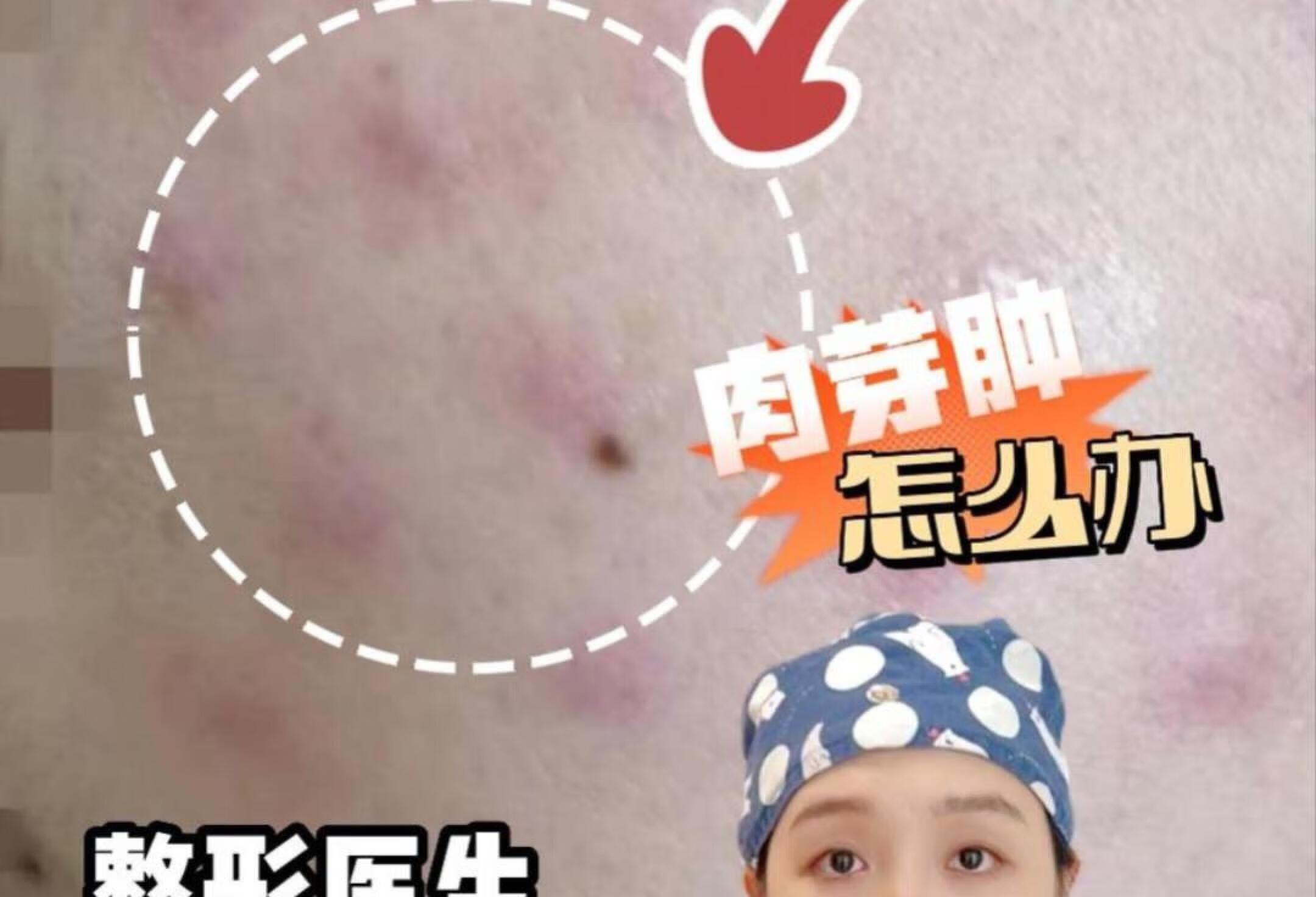 北京市丰台区丰台街道丰益花园社区卫生服务站异物肉芽肿专家【预约挂号_图文问诊_电话问诊】 - 京东健康互联网医院
