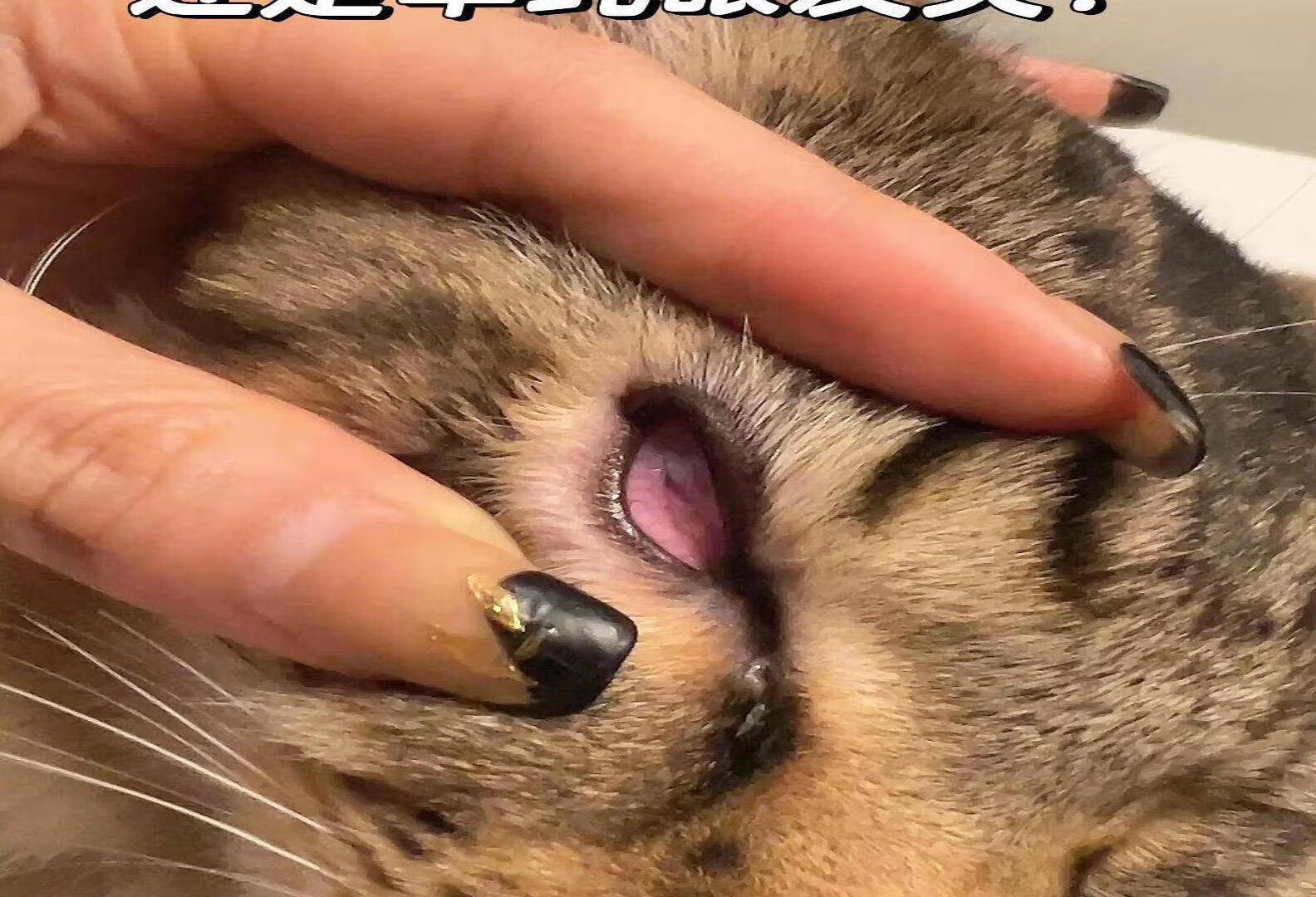 郑州颐和医院眼睑内翻推荐专家