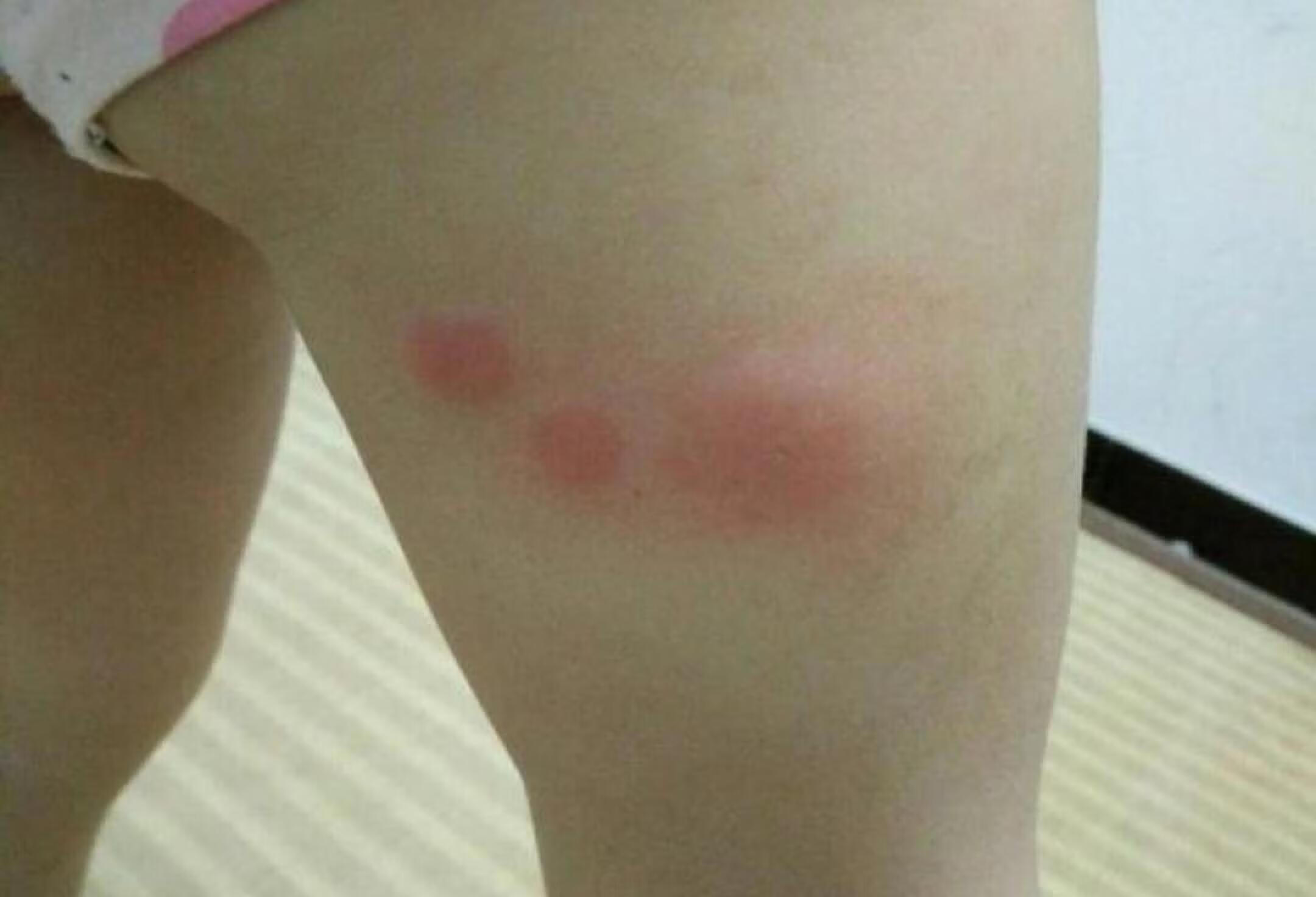 四川省医学科学院四川省人民医院